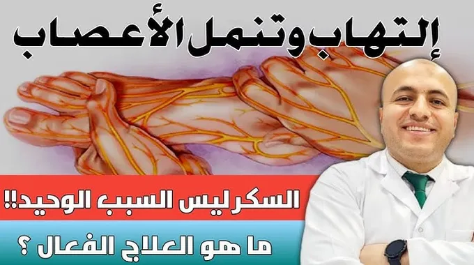 اكتشف أسباب تنميل الأطراف والعلاج الفعّال