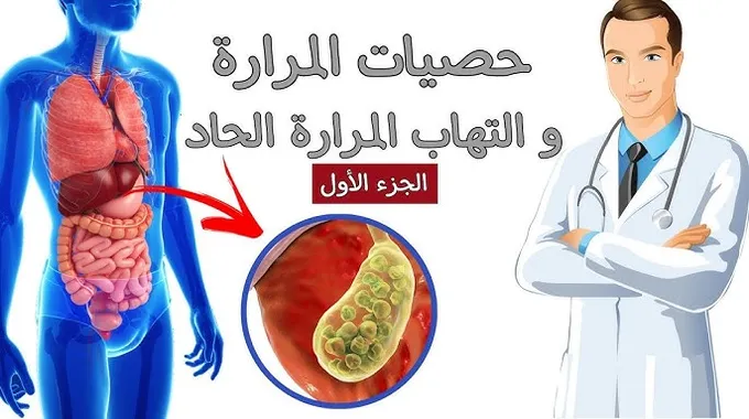 كل ما تحتاج معرفته عن التهاب المرارة