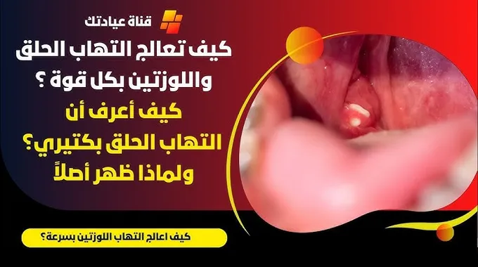 وداعًا لالتهاب الحلق: نصائح سريعة وفعّالة